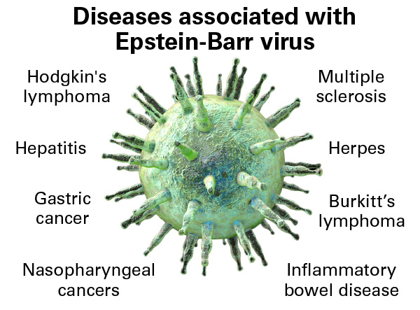 When Epstein-Barr virus becomes a chronic menace: chronic active ...