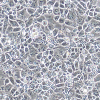 iPS and ES differentiation