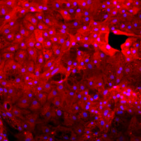 iPS and ES differentiation to hepatocytes