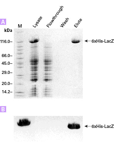 6xHis Monoclonal Antibody detects 6xHis-LacZ