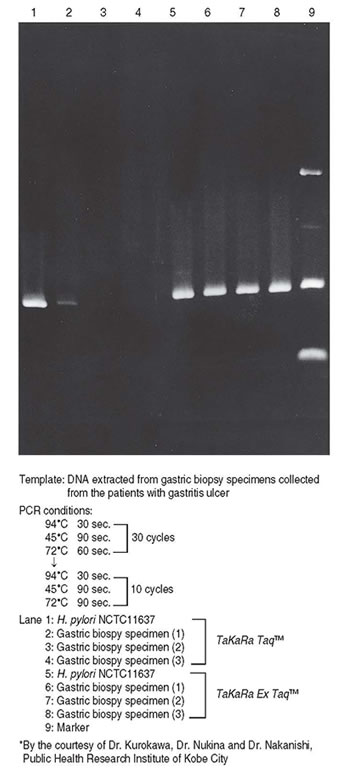 Detection of Helicobacter pylori using PCR amplification with either Takara Taq or Takara Ex Taq DNA Polymerase