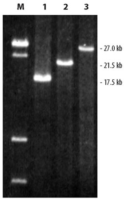 Amplification of human genomic DNA with Takara LA Taq DNA Polymerase