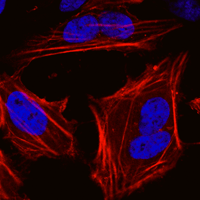 Lentiviral-mediated fluorescent protein transduction