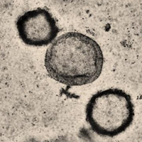 Liver organoid differentiation from iPSCs (ChiPSC18) using the Cellartis DEF-CS 500 Culture System for prediction of drug-induced liver injury