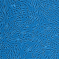 Mesenchymal progenitors