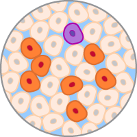 Introducing a disease-related SNP in hiPS cells