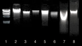 Agarose gel electrophoresis