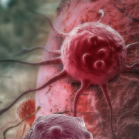 TNBC is one of the most treatment-resistant types of breast cancer.
