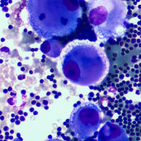 The future of cancer warfare