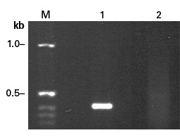 Amplification of a fragment of the rare tumor necrosis factor receptor II (TNFR II) cDNA with Advantage 2 Polymerase Mix and a competitor's Taq polymerase mix