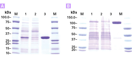 Purification of his-tagged proteins using TALON Magnetic Beads