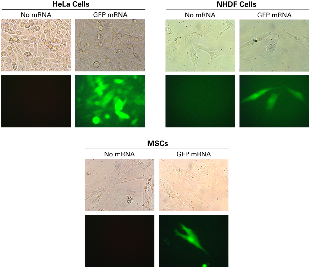 GFP is expressed in HeLa cells, NHDF cells, and MSCs