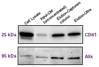 Western blot analysis for characteristic exosome proteins