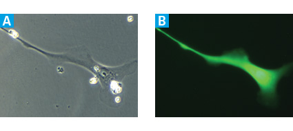 Transduction of neural progenitor cells by Lenti-X lentivirus