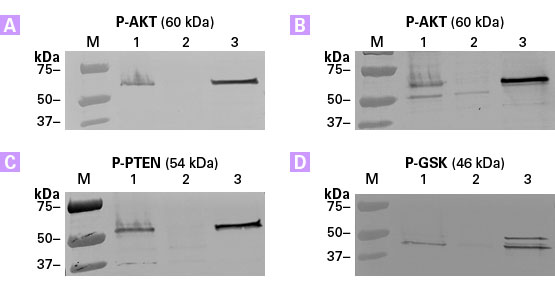 Highly effective enrichment of phosphorylated proteins using the TALON PMAC Magnetic Phospho Enrichment Kit