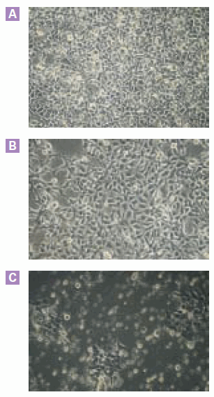 Tetracycline-inducible expression of cytotoxic proteins