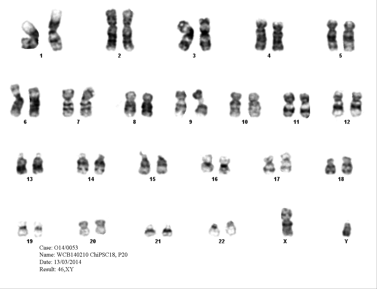 Human induced pluripotent stem (iPS) cells cultured long-term in the Cellartis DEF-CS Culture System retain a normal karyotype