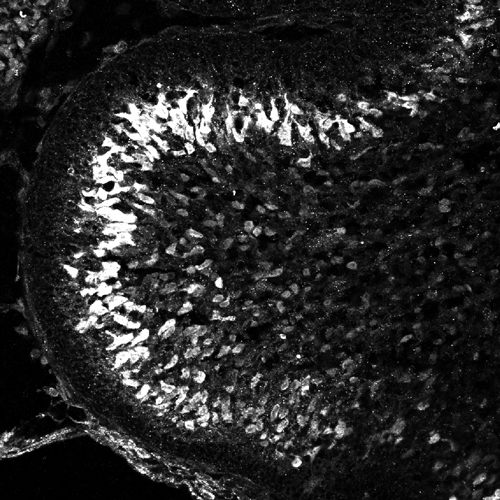 Immunohistochemical staining with Polyclonal Antibody to Mouse L7/Pcp2Postnatal (Cat