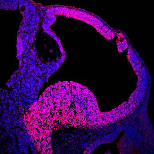 Immunohistochemical Staining with Anti-Human/Mouse Bf1, Polyclonal (Cat