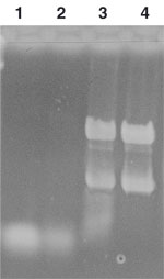 Formamide/formaldehyde gel electrophoresis of bacterial total RNA purified with the NucleoBond RNA/DNA kit