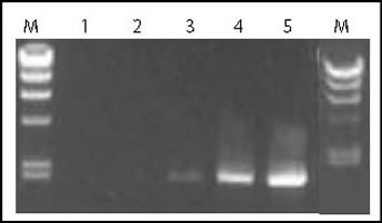 Amplification of a 2 kb lambda-DNA Fragment with e2TAK DNA Polymerase and Company P's DNA Polymerase