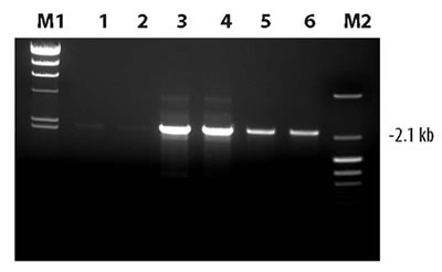 Comparison of Takara LA Taq with GC Buffer and Takara LA Taq DNA polymerase for amplification of a GC-rich target fragment