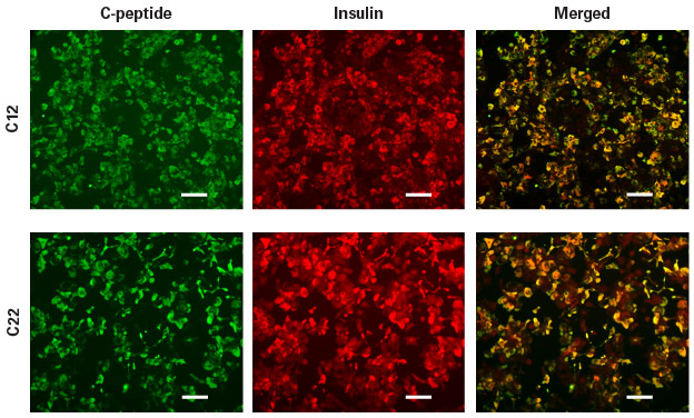 Human iPS cell-derived beta cells synthesize and secret insulin.
